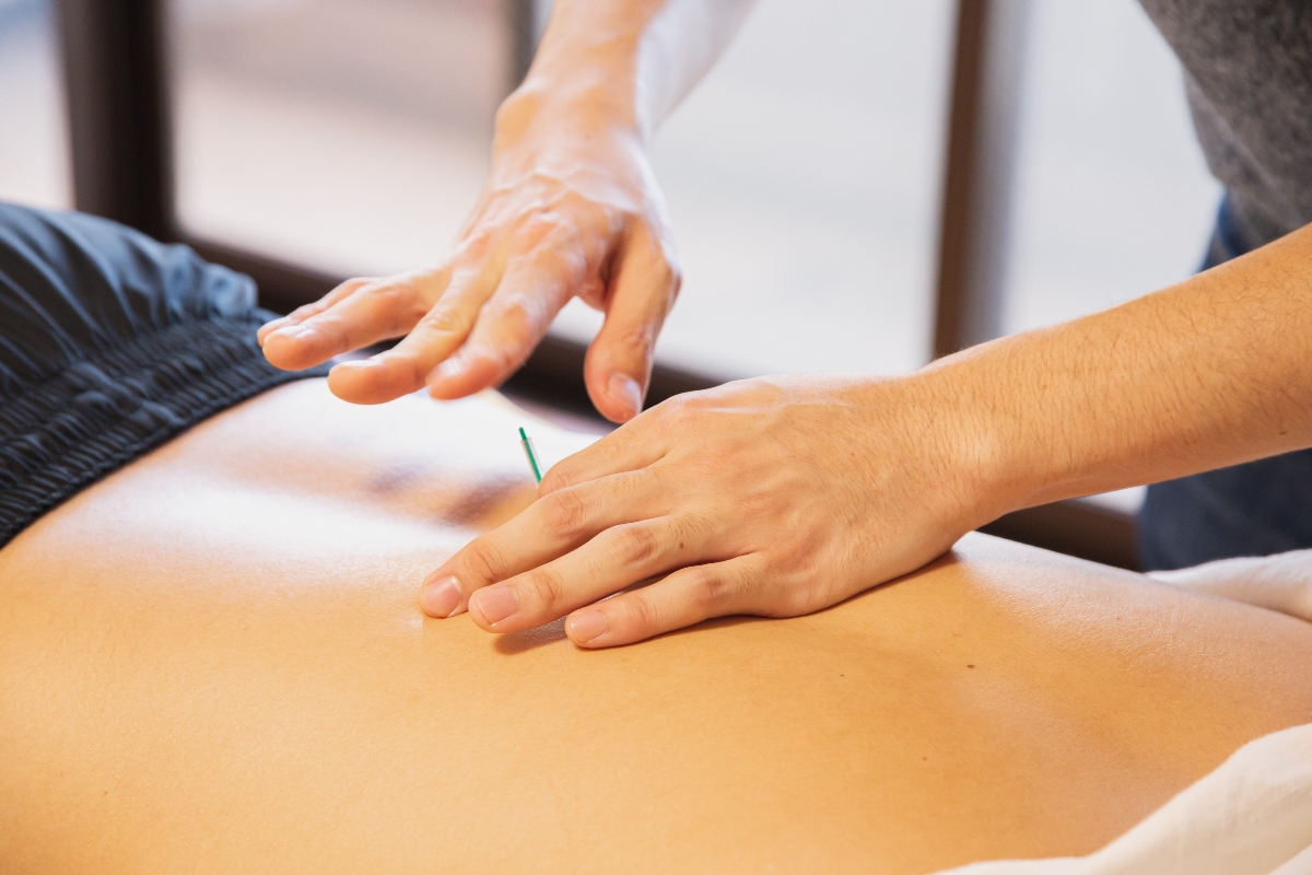 Acupuncture Treatments in UK